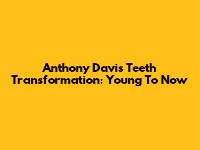Anthony Davis' Teeth Transformation: Young To Now