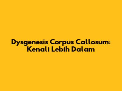 Dysgenesis Corpus Callosum: Kenali Lebih Dalam
