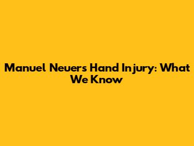 Manuel Neuer's Hand Injury: What We Know