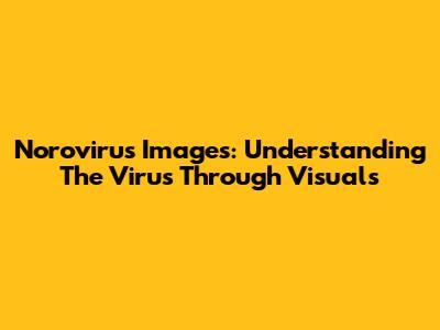 Norovirus Images: Understanding The Virus Through Visuals