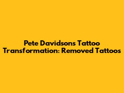 Pete Davidson's Tattoo Transformation: Removed Tattoos