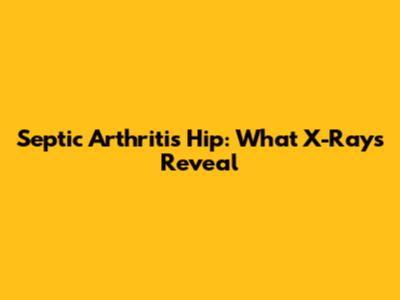 Septic Arthritis Hip: What X-Rays Reveal
